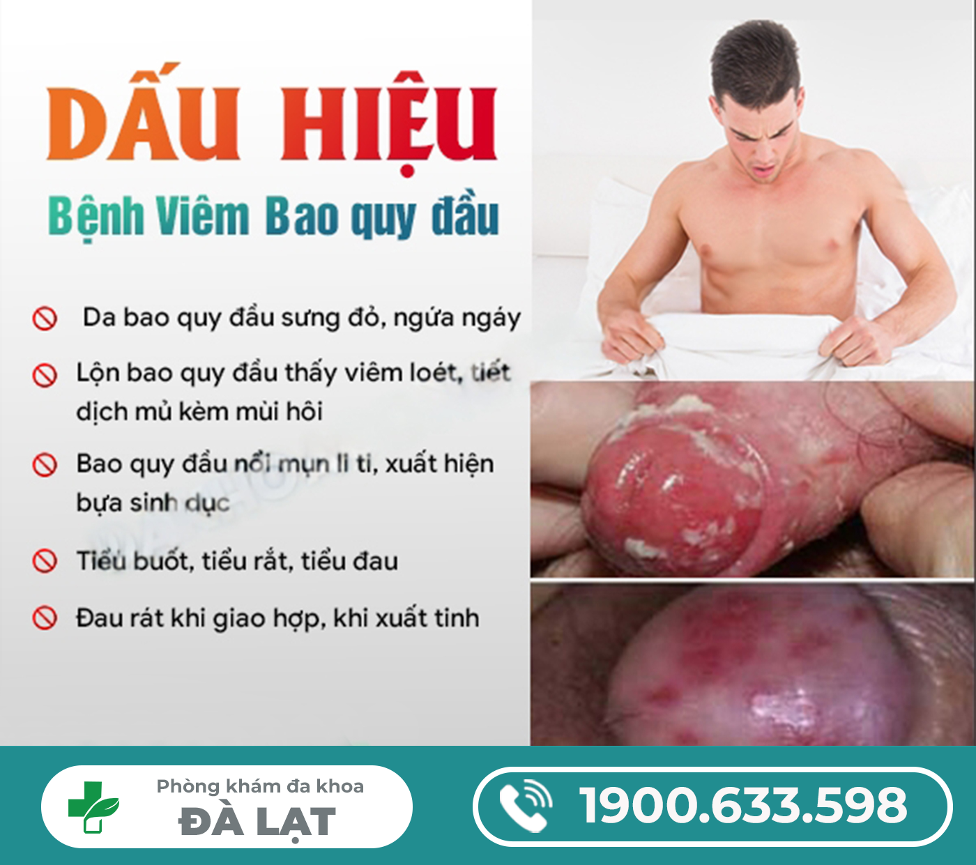 Hình ảnh minh họa